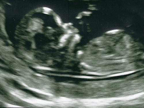 12 week ultrasound picture