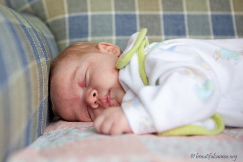 Hope asleep