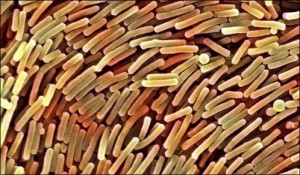 brown c-diff