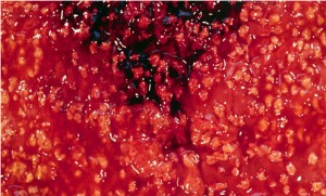red c-diff